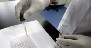 ¿Tu pareja se hizo el test de VIH?: el inquietante dato sobre los mayores de 30 años y los casos positivos